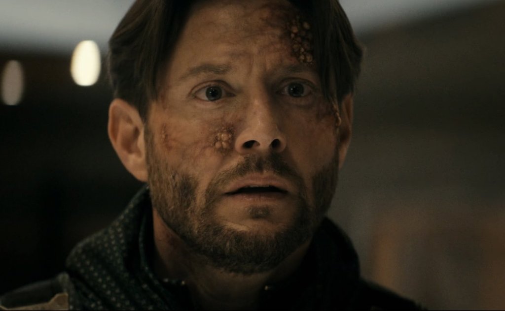 Close-up of Jensen Ackles as Solider boy face showing visible skin lesions and scratches on his forehead, cheek, and nose, with a look of shock or distress in the boys season 5.